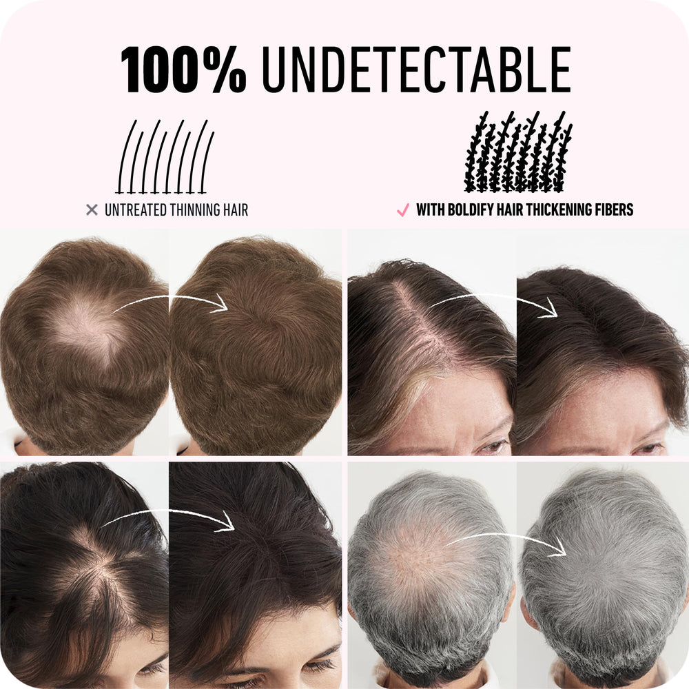 Boldify: couverture du cuir chevelu et raie bien définie