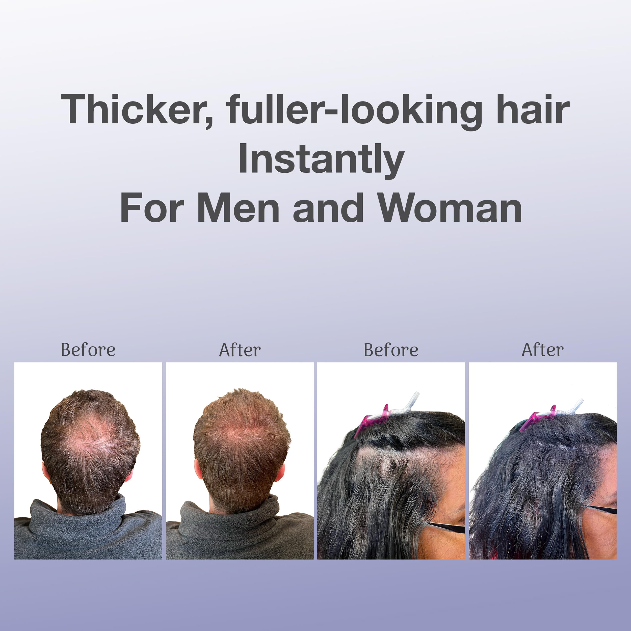 BosleyMD Fibres couverture cheveux fins, densité visuelle renforcée.