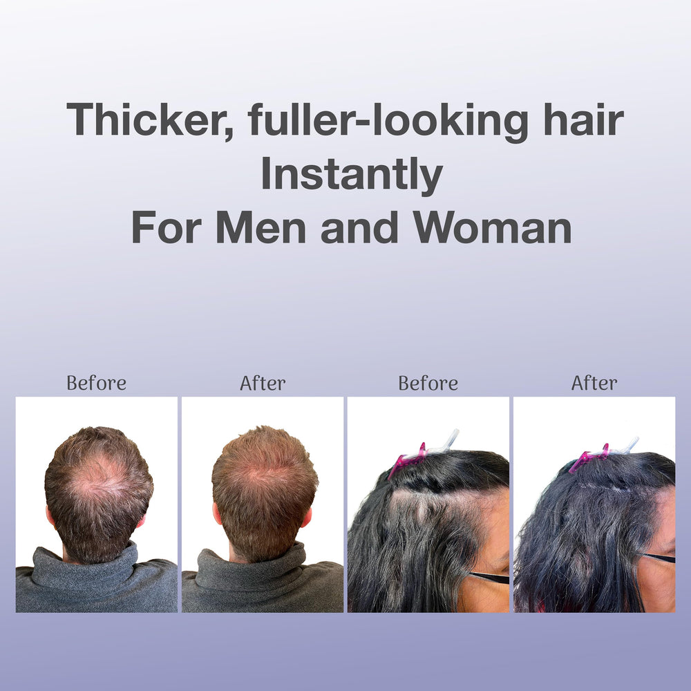 BosleyMD Fibres couverture cheveux fins, densité visuelle renforcée.