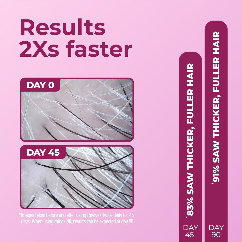 BosleyMD Revive+ sérum cheveux fins : renforce les fibres et donne du volume.