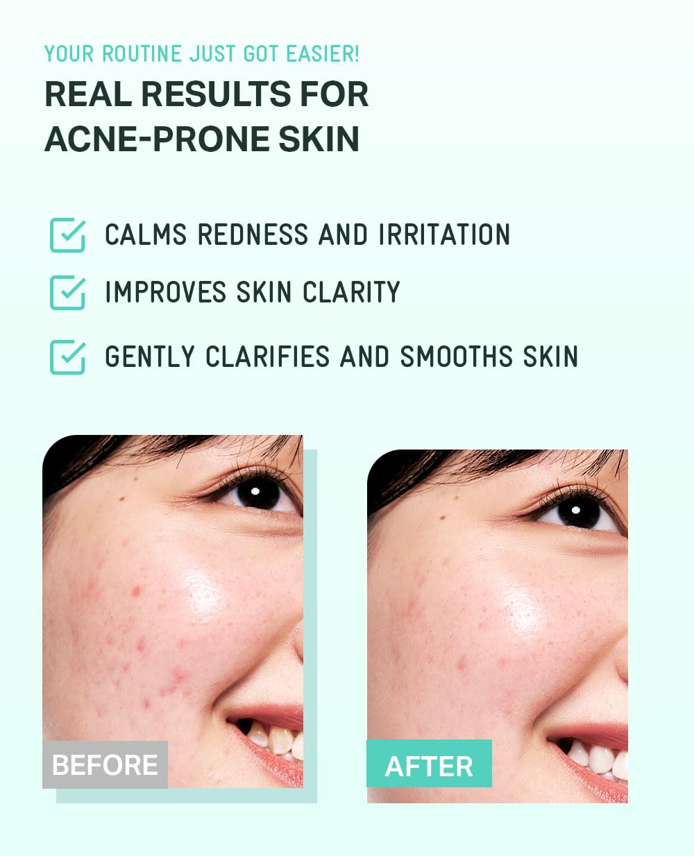 BRING GREEN Tea Tree CICA Toner, peau légèrement rafraîchie après l’application.