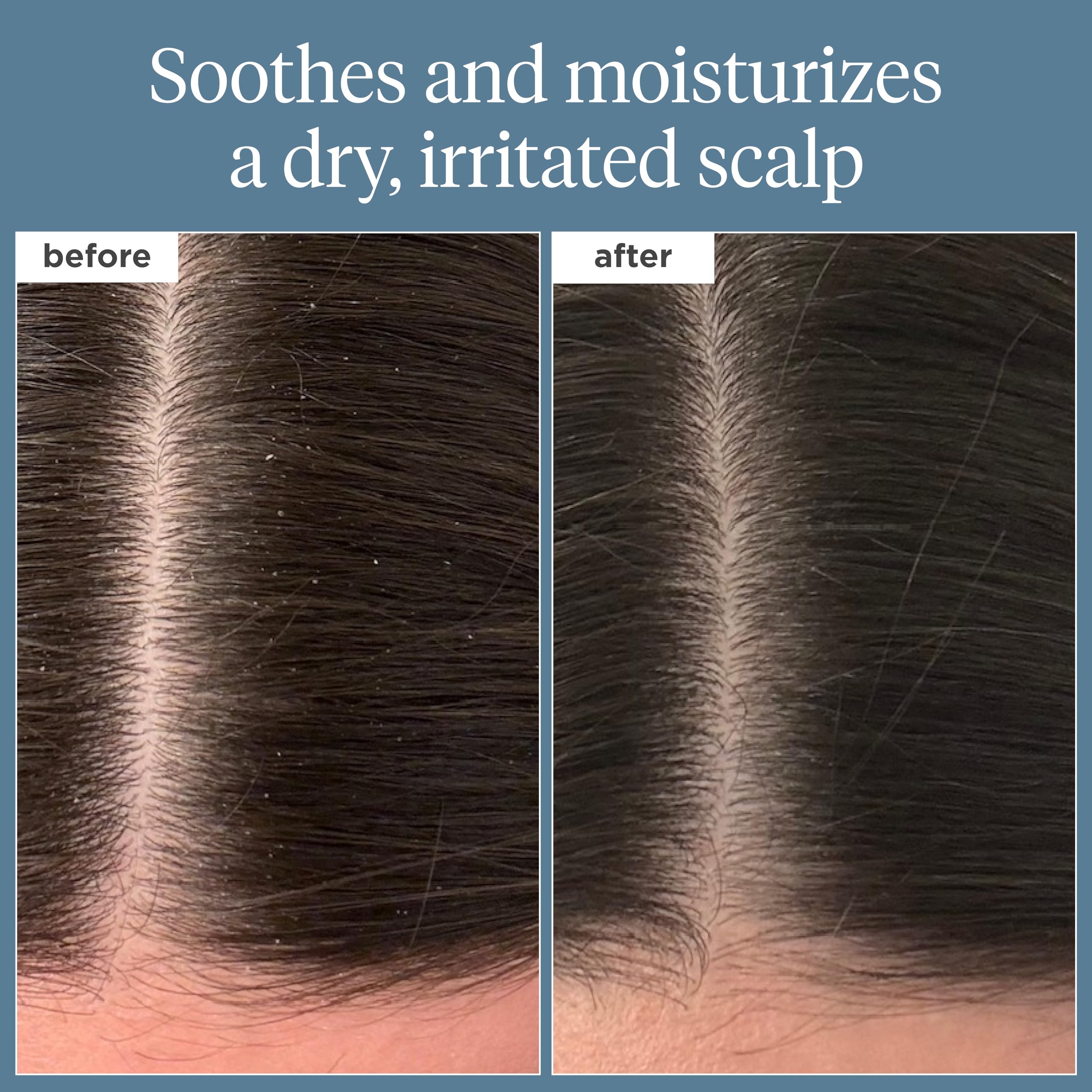 Briogeo Scalp Revival huile romarin nourrissant pour cuir chevelu.
