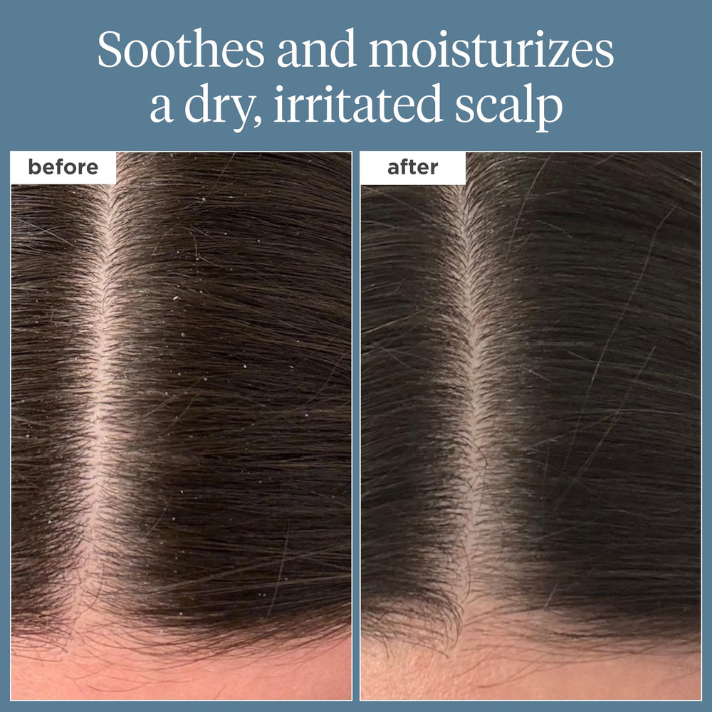Briogeo Scalp Revival huile romarin nourrissant pour cuir chevelu.