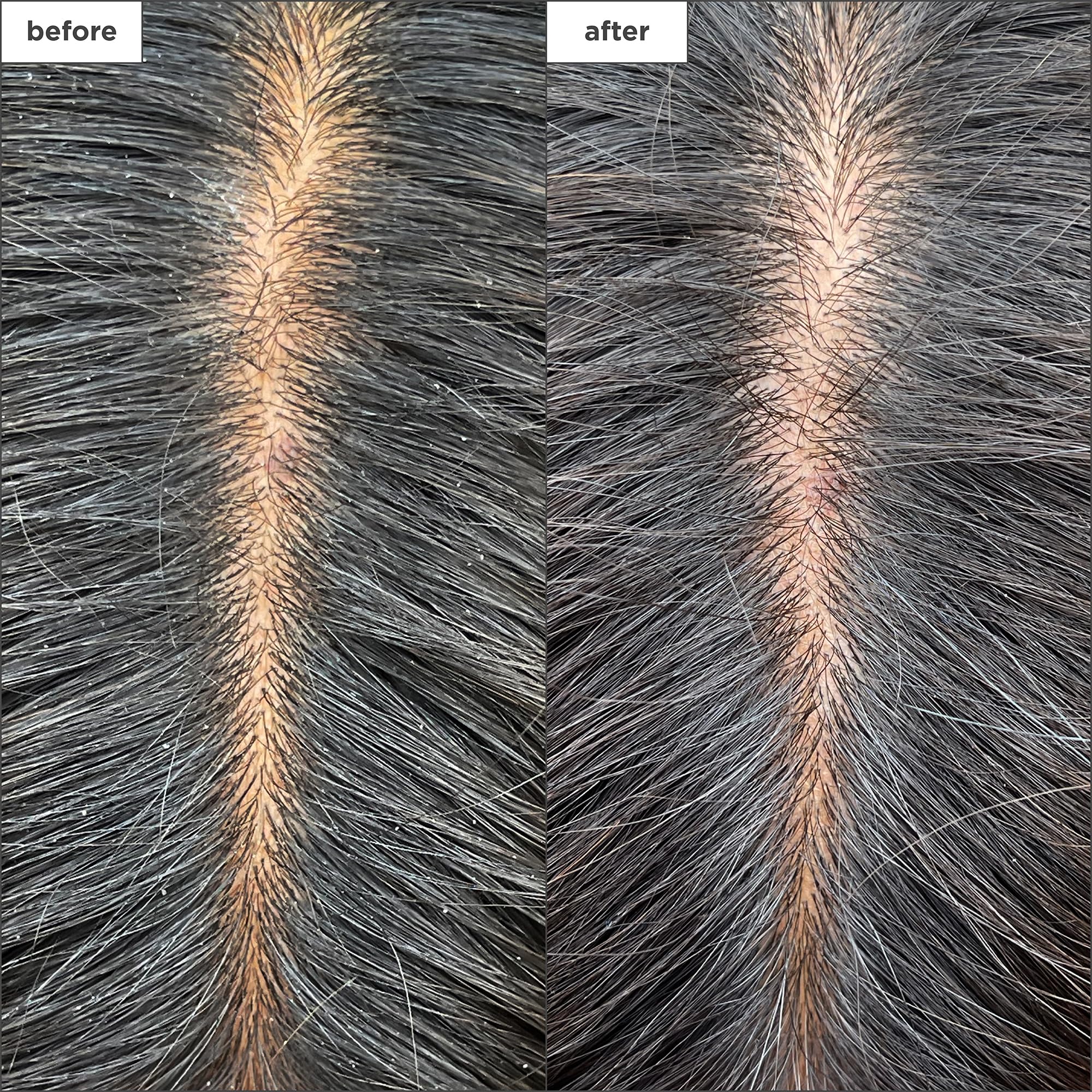 Briogeo Scalp Revival – application en massage avec sensation rafraîchissante.