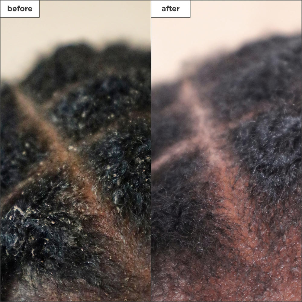 Sensation apaisante immédiate sur cuir chevelu Briogeo Scalp Revival