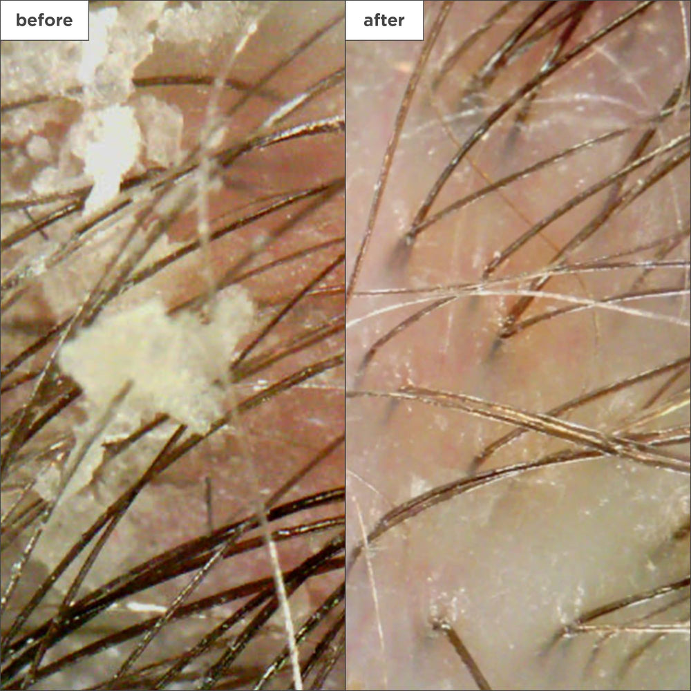 Micro-exfoliation douce qui aide à repousser les résidus sans dessécher.