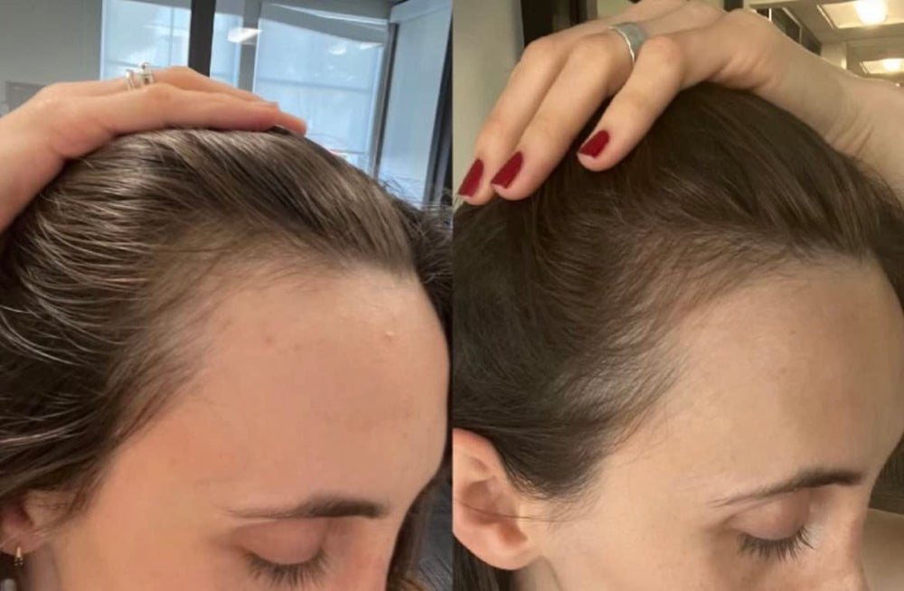 Réparation visuelle des cheveux secs après utilisation Bur Bur