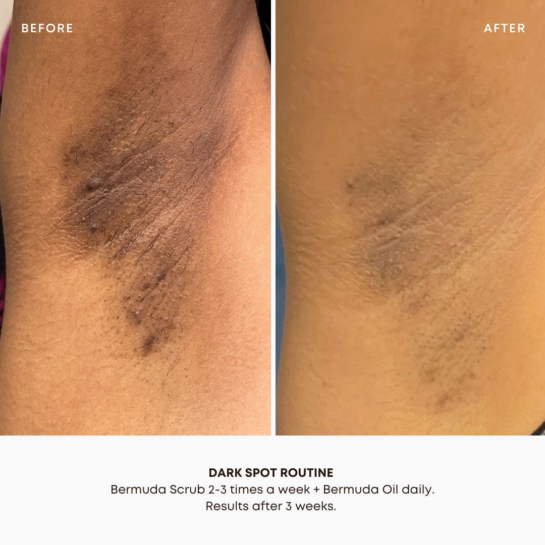 Bushbalm Bermuda étape-simple-2-étapes; gommage puis huile pour une routine claire.