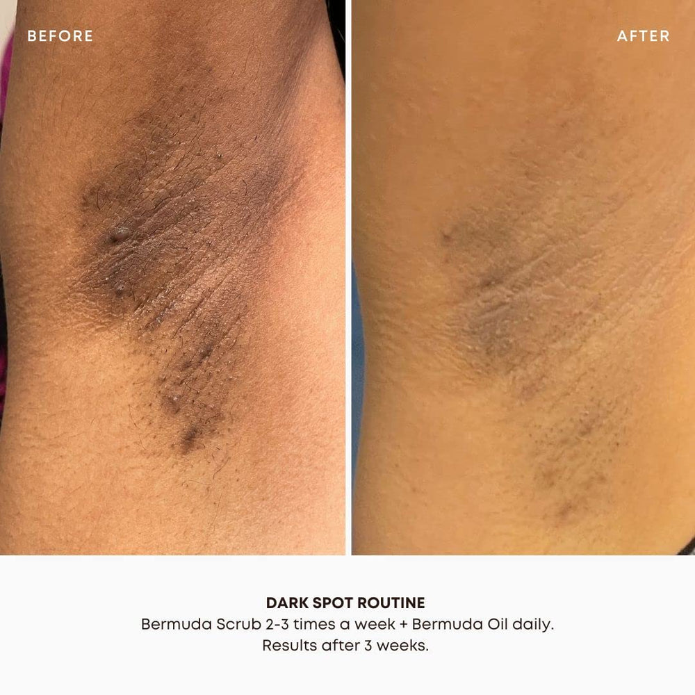 Bushbalm Bermuda étape-simple-2-étapes; gommage puis huile pour une routine claire.