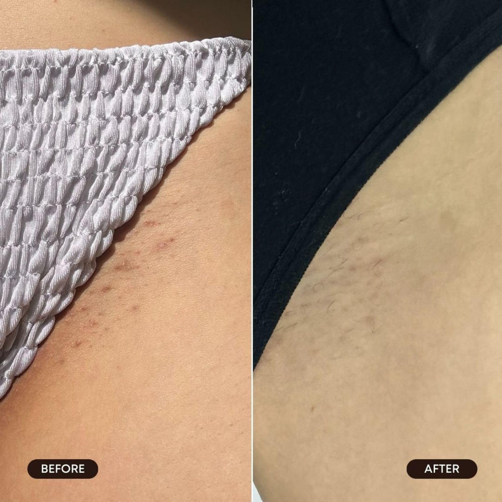 Bushbalm Roller Rescue underarms application shows discreet use.