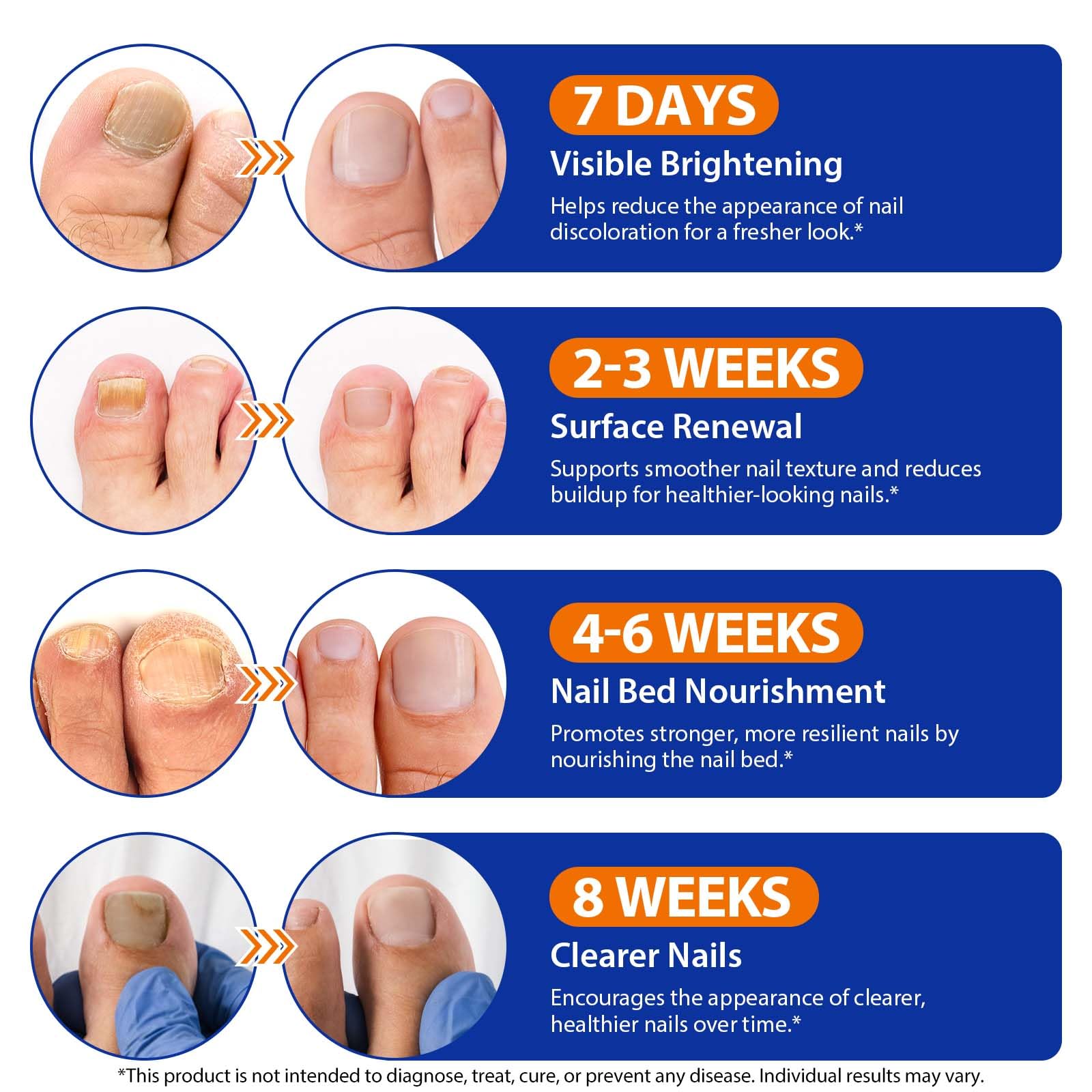 Avant et après l’utilisation des patchs Buyourtaste sur ongles