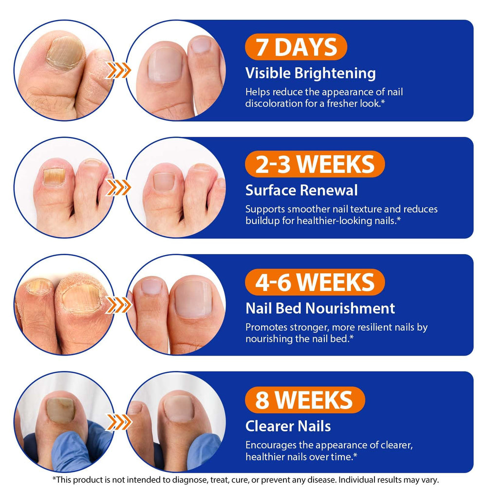 Avant et après l’utilisation des patchs Buyourtaste sur ongles