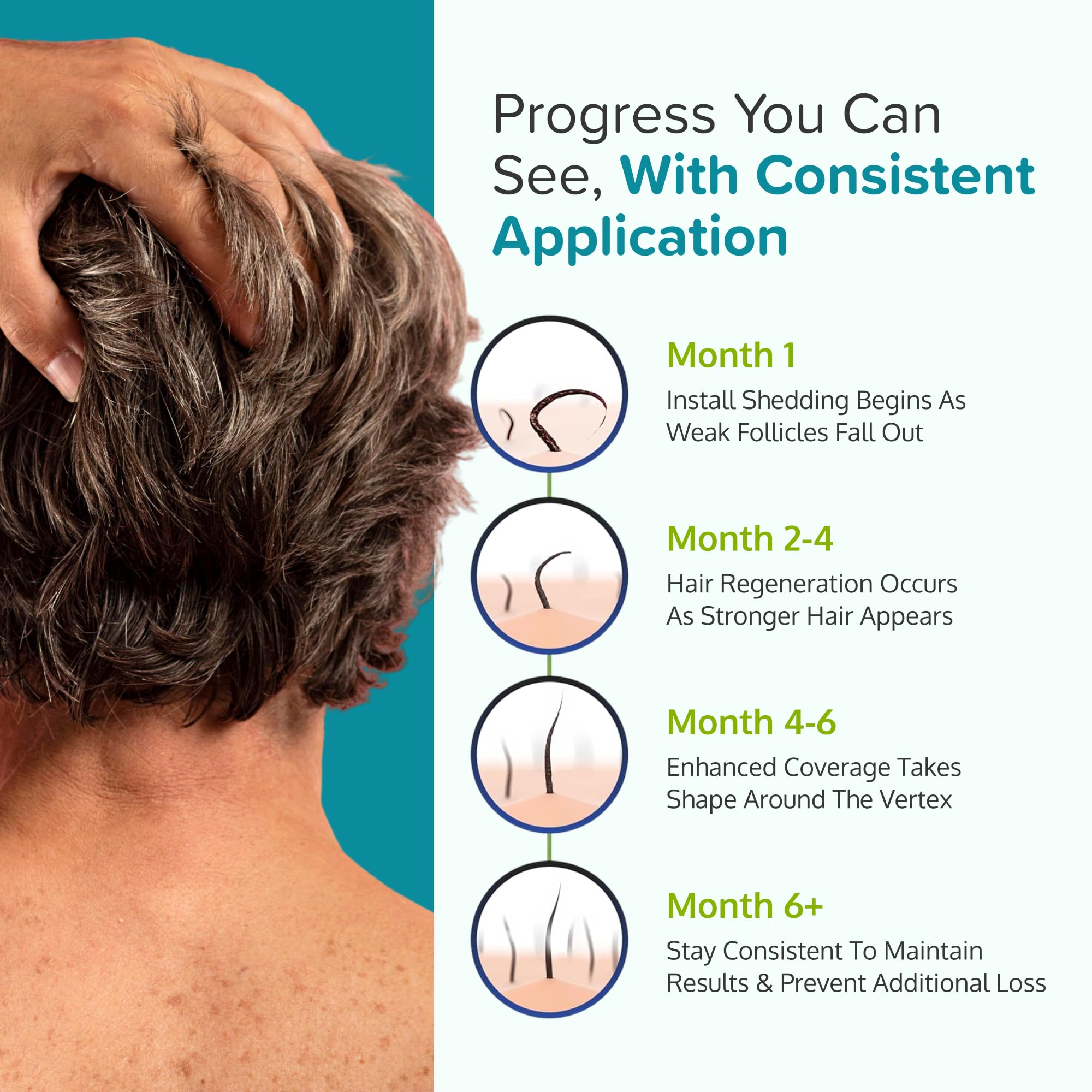C’rcle Minoxidil Foam – résultats potentiels, utilisation simple et discrète.