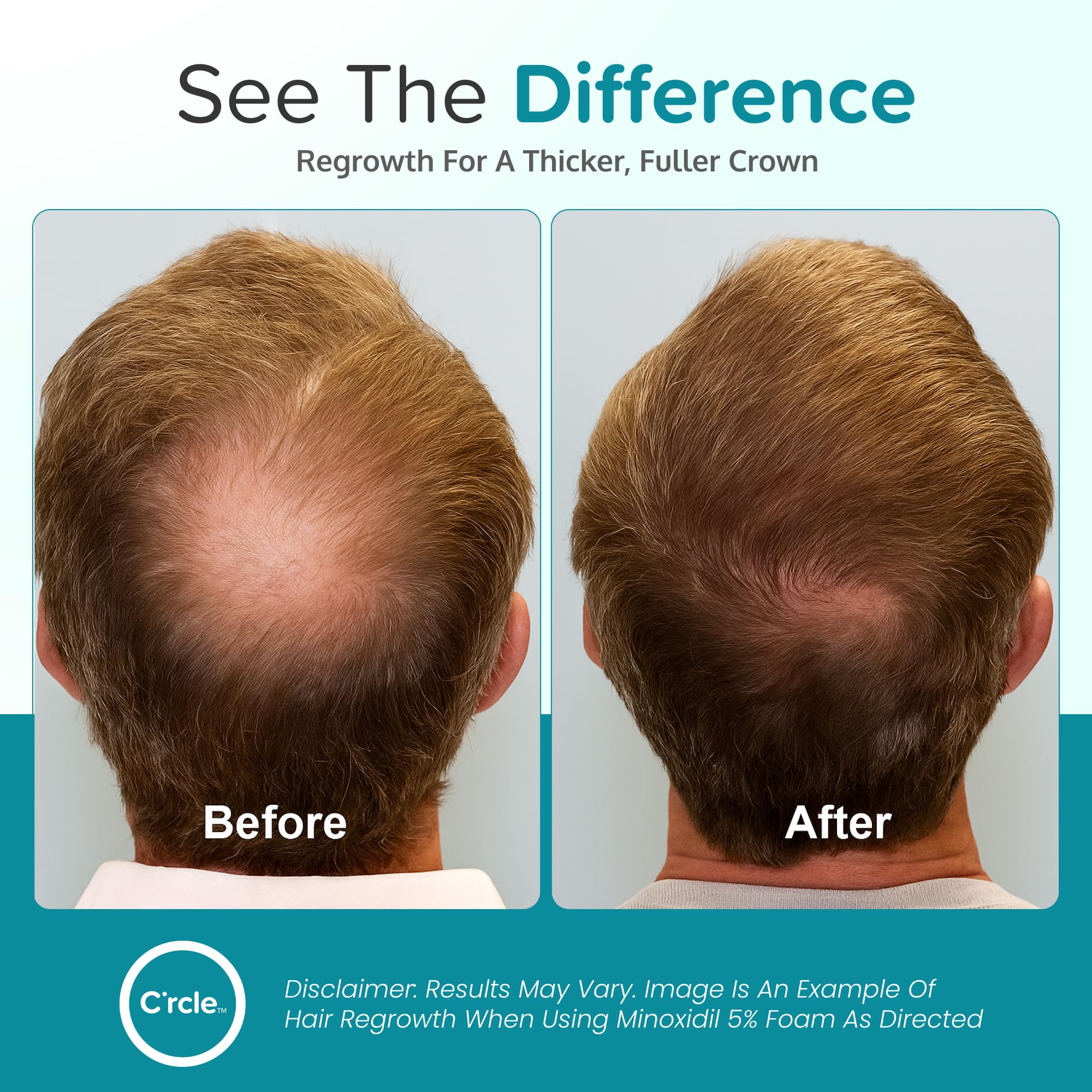C’rcle Minoxidil Foam – texture légère facilitant une répartition uniforme.