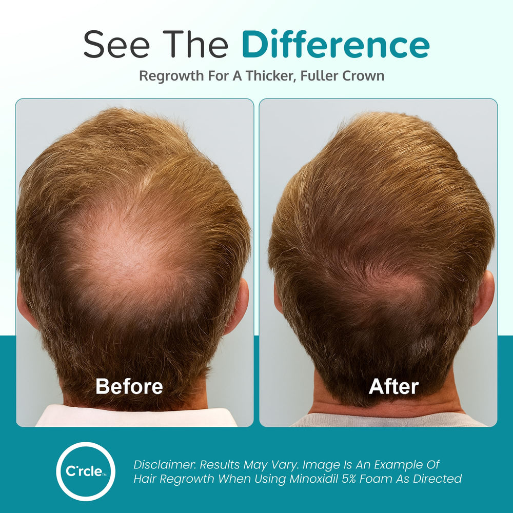 C’rcle Minoxidil Foam – texture légère facilitant une répartition uniforme.