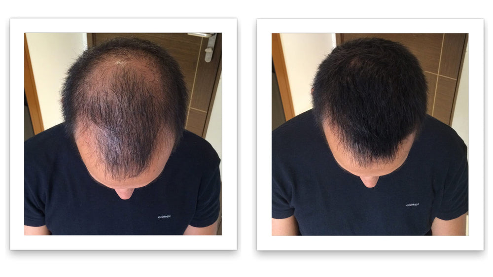 Caboki absence residus gras noir — fini naturel et mat