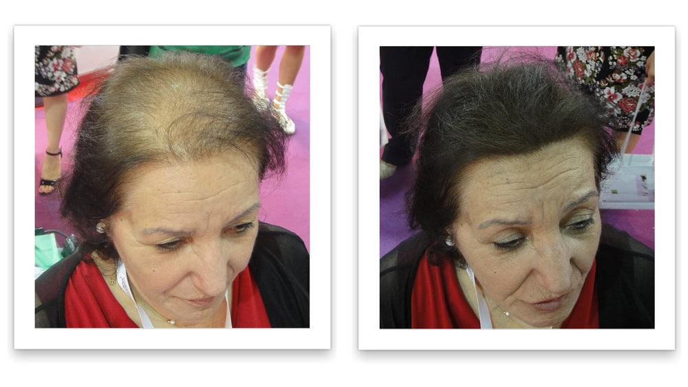 Caboki aperçu après: cheveux visiblement plus denses.