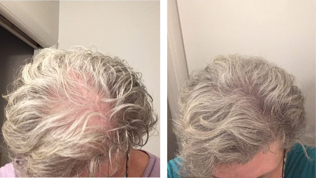 Caboki donne une couverture des cheveux fins pour un aspect plus épais.