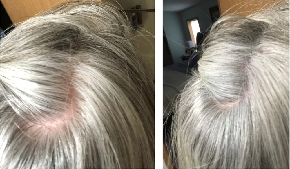 Caboki constitue une solution capillaire pratique pour les cheveux clairsemés.