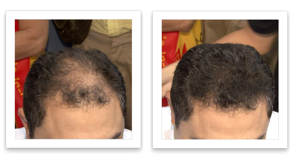Caboki effet 10x plus dense sur cheveux clairsemés pour un look naturel.