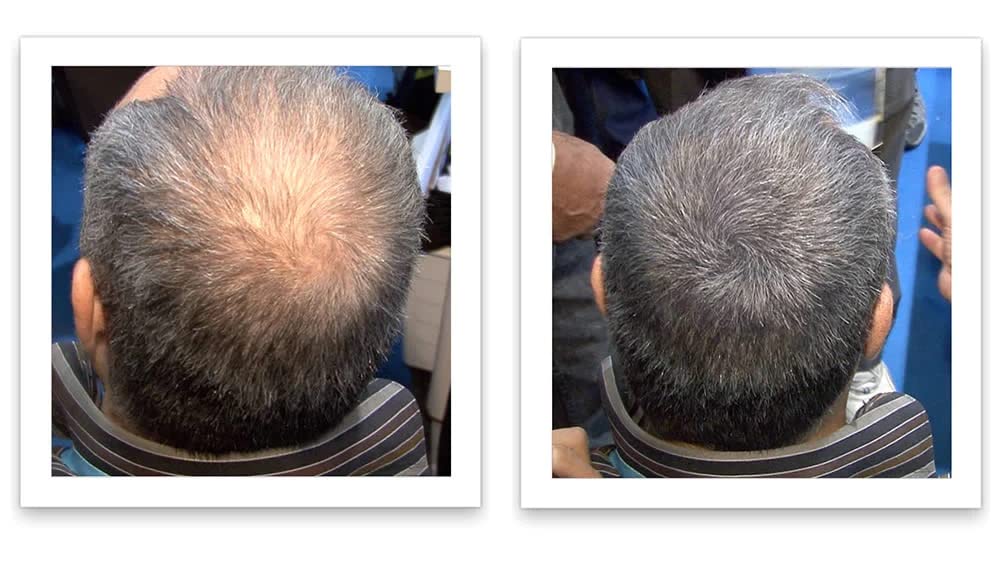 Caboki, poudre-100-naturel : formulation végétale pour une fibre capillaire naturelle.