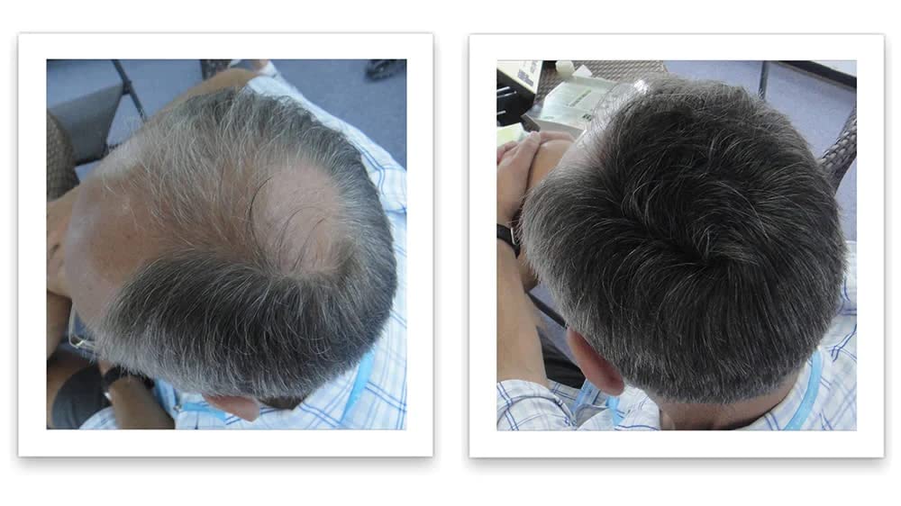 Caboki, poudre-effet-plume-cheveux-fins : effet volumateur pour cheveux fins.