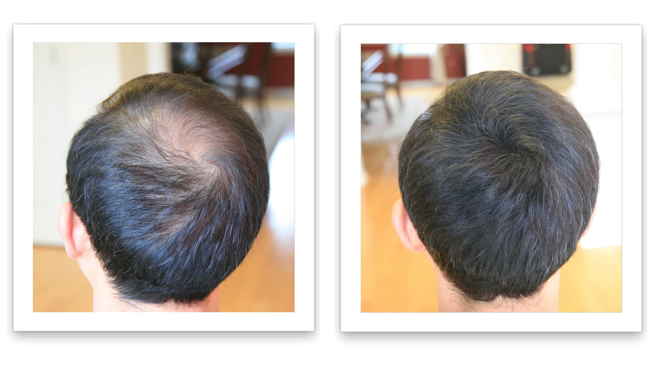 Caboki sans colorants artificiels noir — formule naturelle