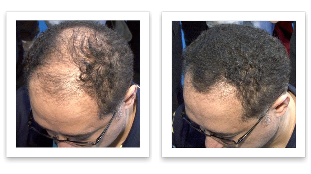 Caboki volume cheveux minces noir — densité visuelle instantanée