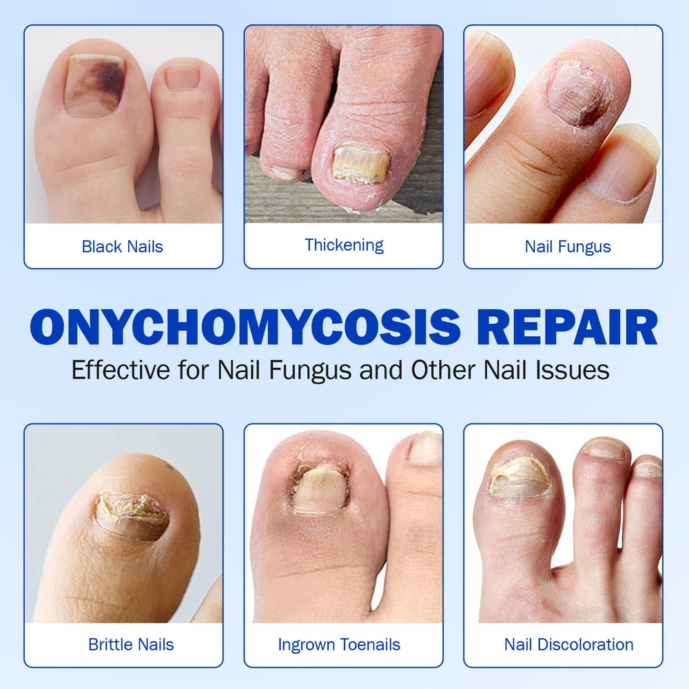 Ongles fragiles renforcés par Cacukn, solution douce et efficace.
