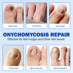 Ongles fragiles renforcés par Cacukn, solution douce et efficace.
