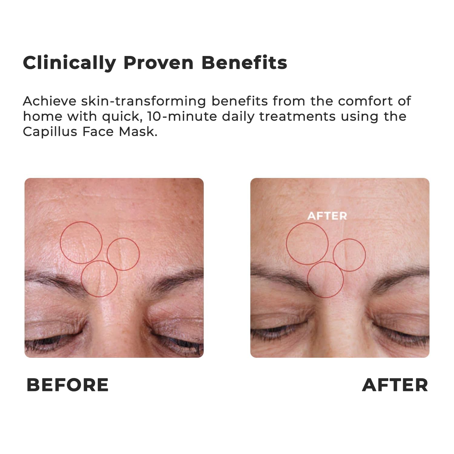 Capillus Masque lumière rose sur le visage pour un teint lumineux