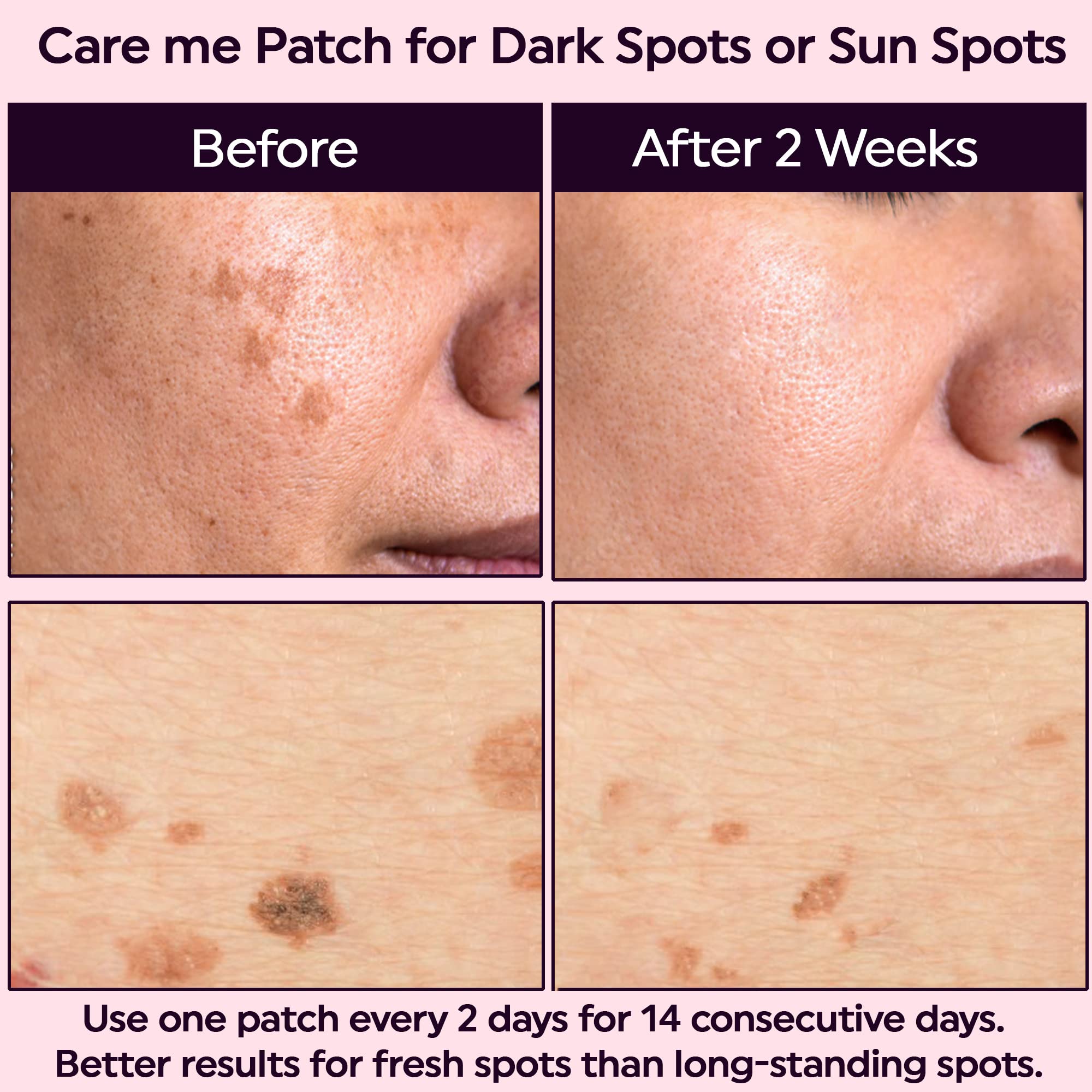 Care me Microdart pansement invisible sous maquillage.