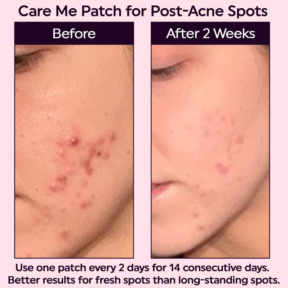 Care me Microdart pansement pour une utilisation nocturne efficace.