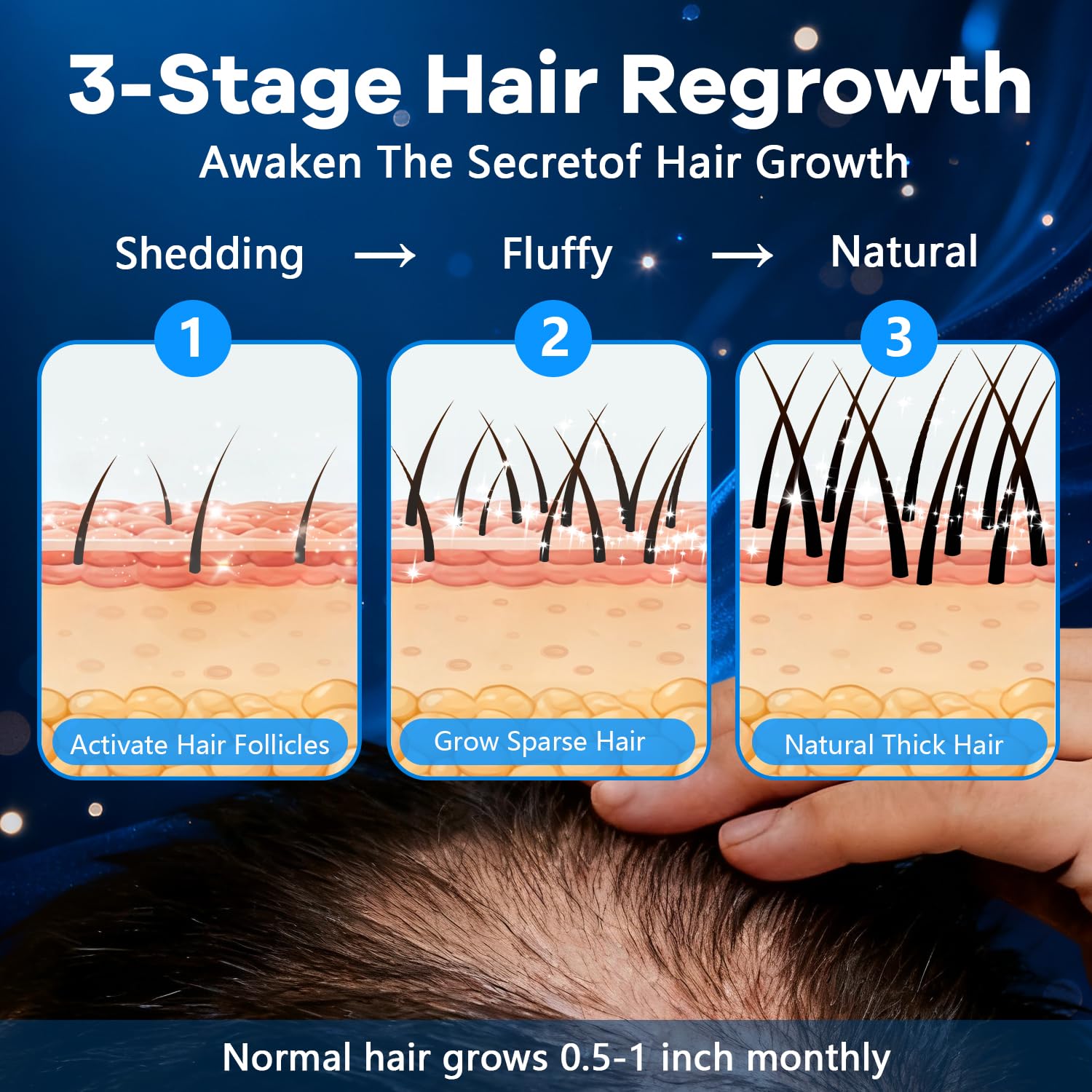 CARENICE Minoxidil Mousse texture légère sur scalp