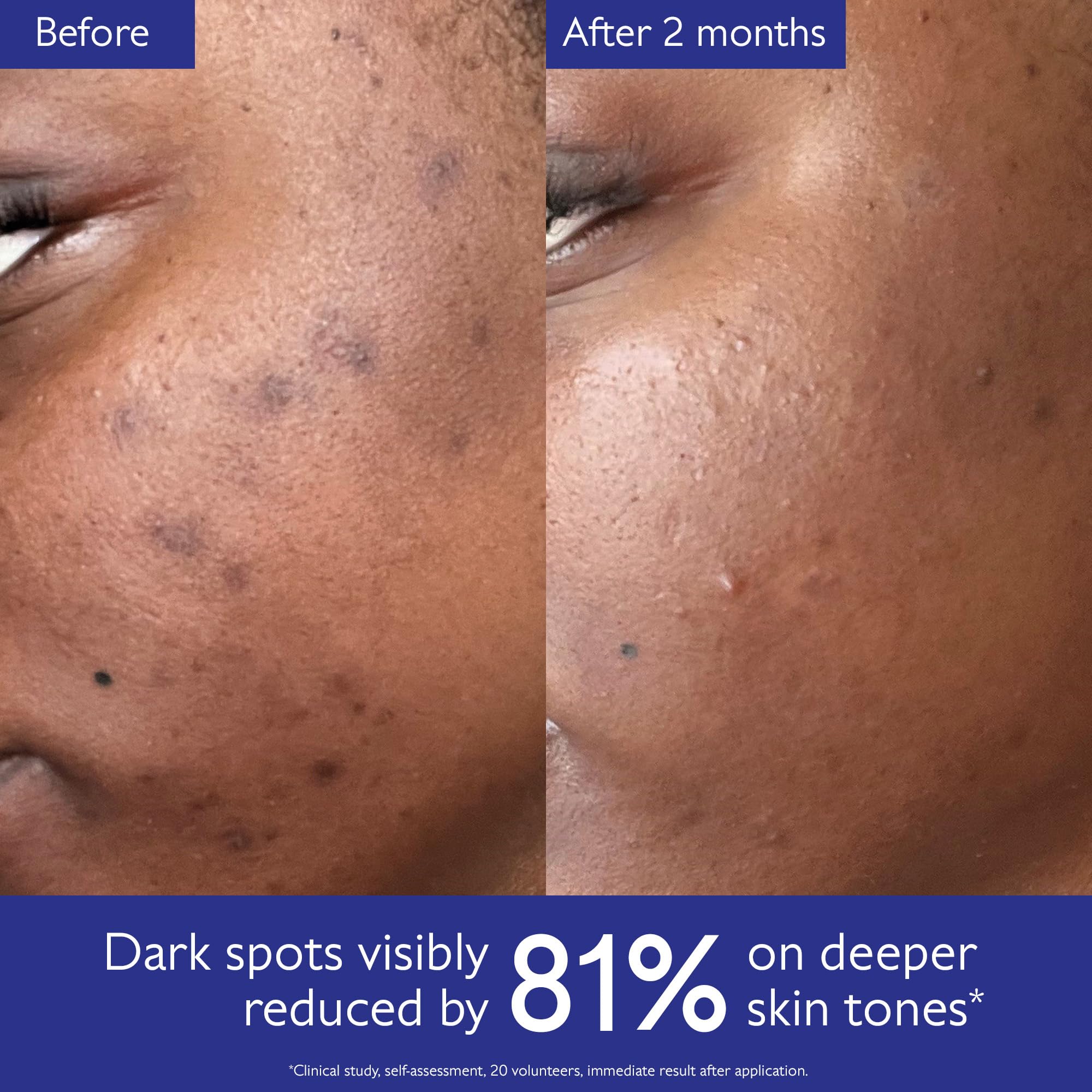 Absorption rapide, parfaite avant la crème de jour ou nuit.