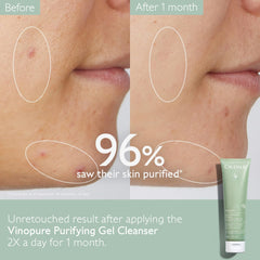 Caudalie Vinopure : acide salicylique purifiant pour les pores