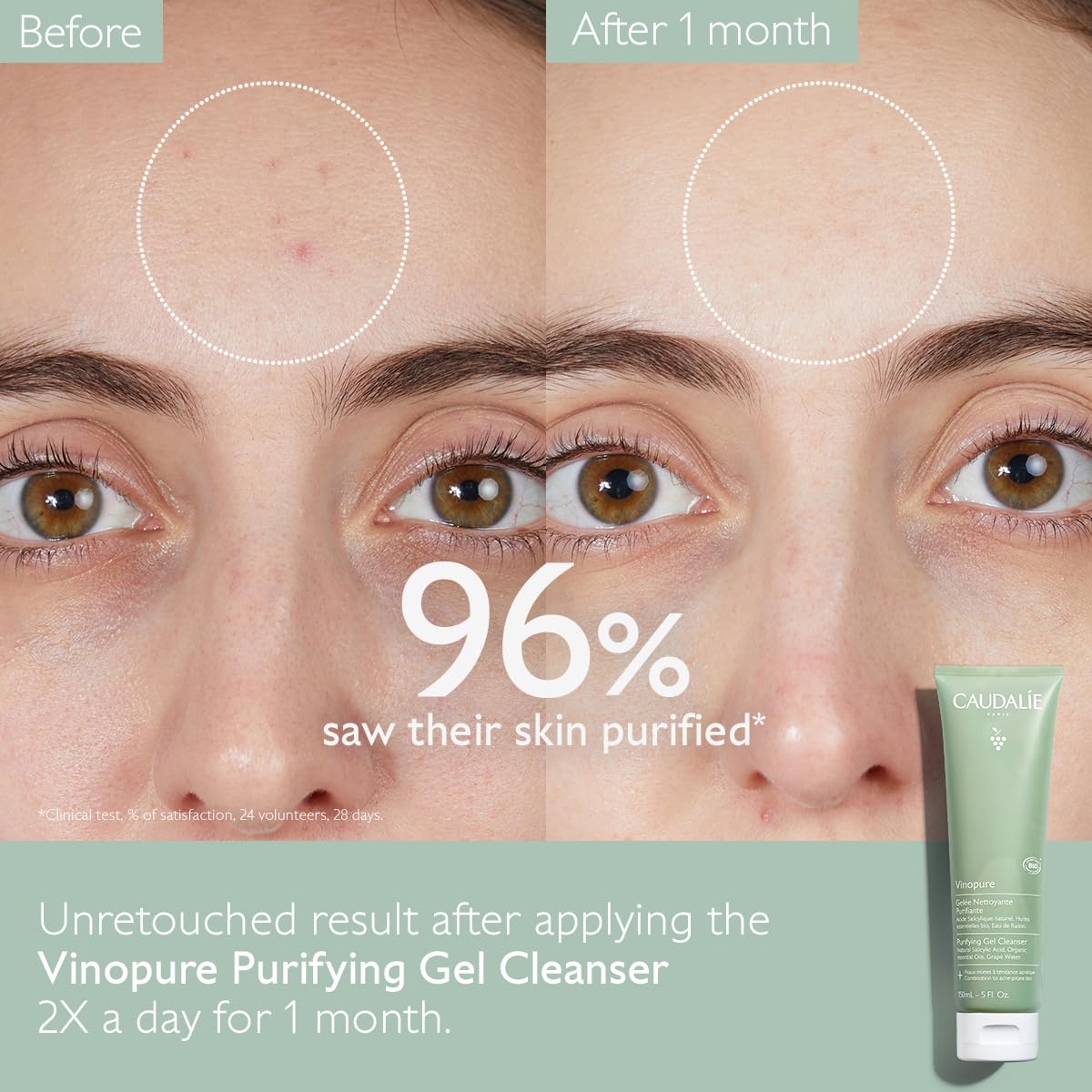 Caudalie Vinopure : eau de raisin hydratante et acide salicylique
