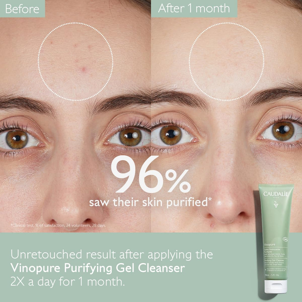 Caudalie Vinopure : eau de raisin hydratante et acide salicylique