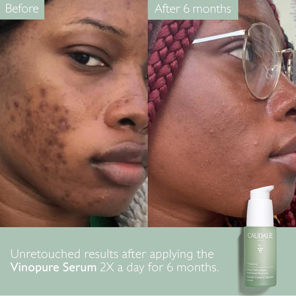 Caudalie Vinopure - peau moins brillante et plus équilibrée.
