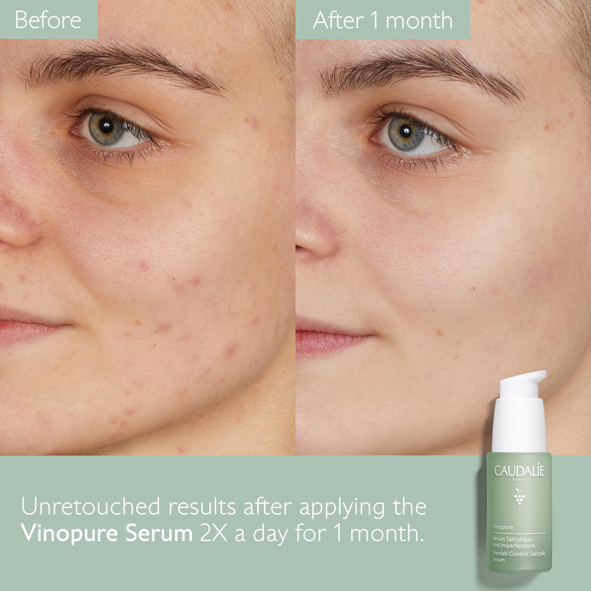 Caudalie Vinopure - pores visiblement resserrés après utilisation.