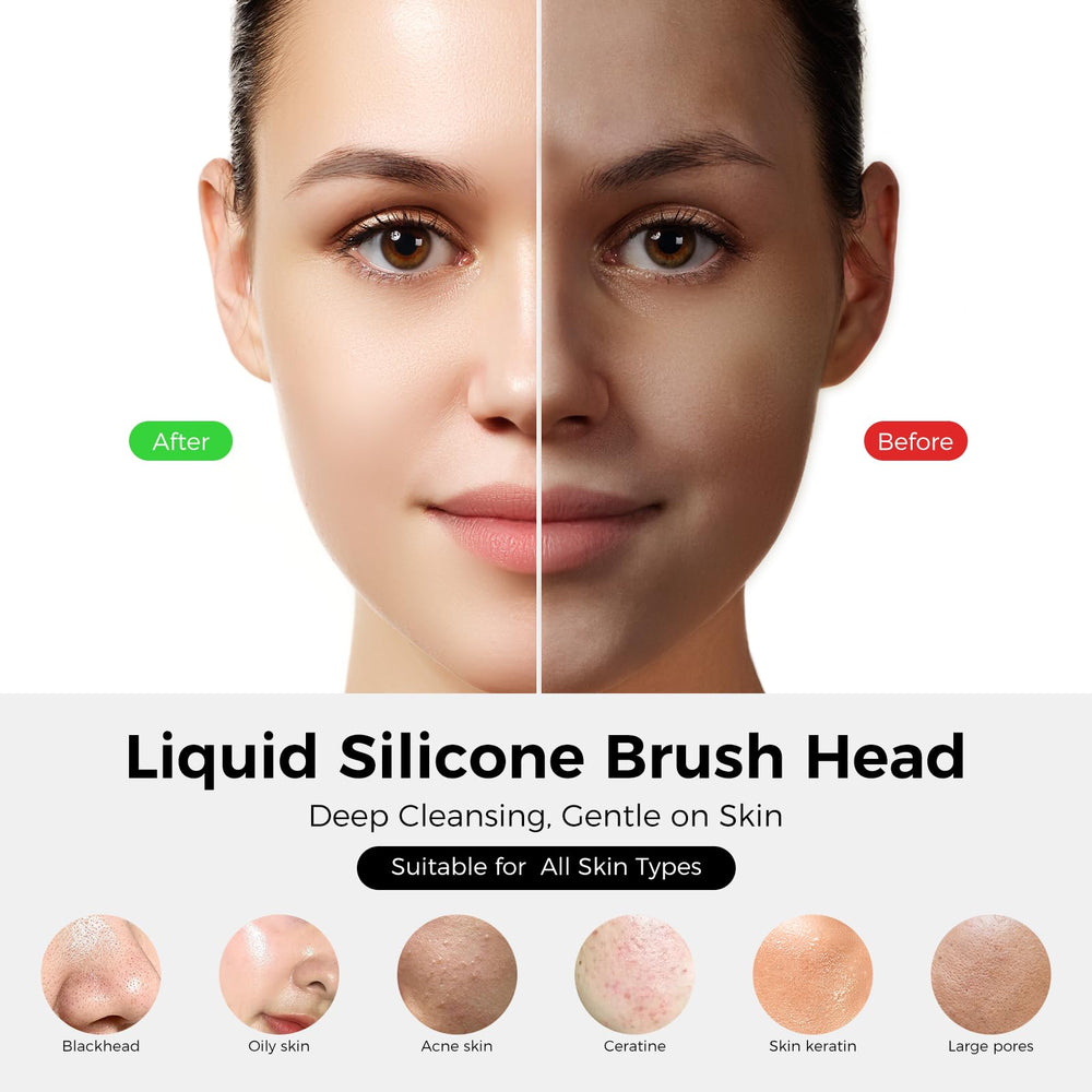 Ccigedy brosse-visage micro-vibrations délogent saletés et sébum en douceur.