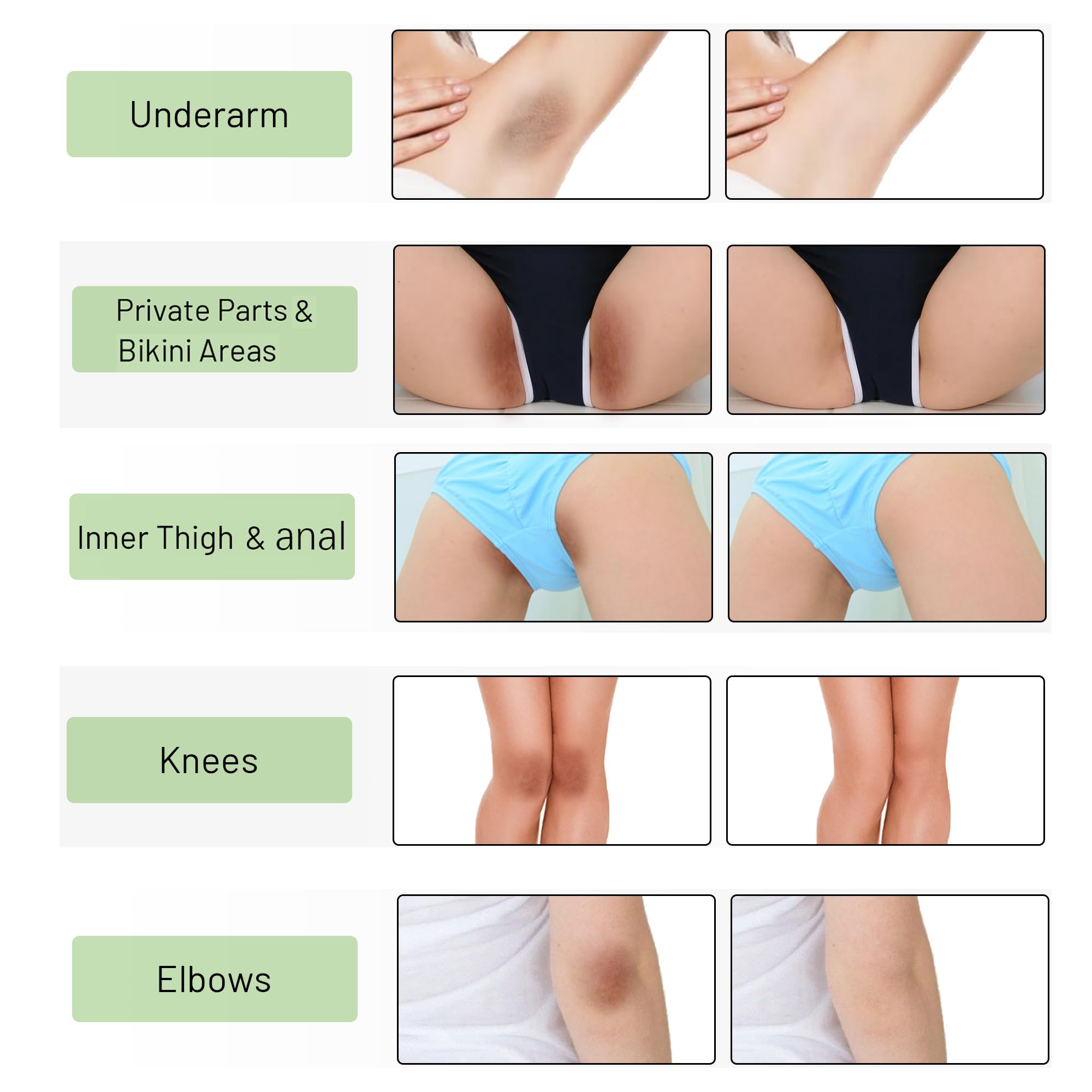 Ceavo crème éclaircissante pour les axilles, teint plus clair