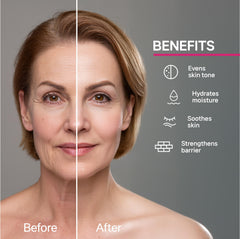 CELDYQUE Tranexamic Acid 5% cream jar targets uneven skin tone