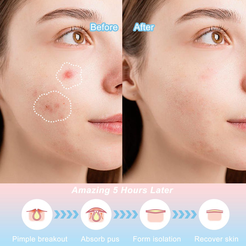 CELECARE patch petites étoiles, couverture fiable et hygiène pratique.
