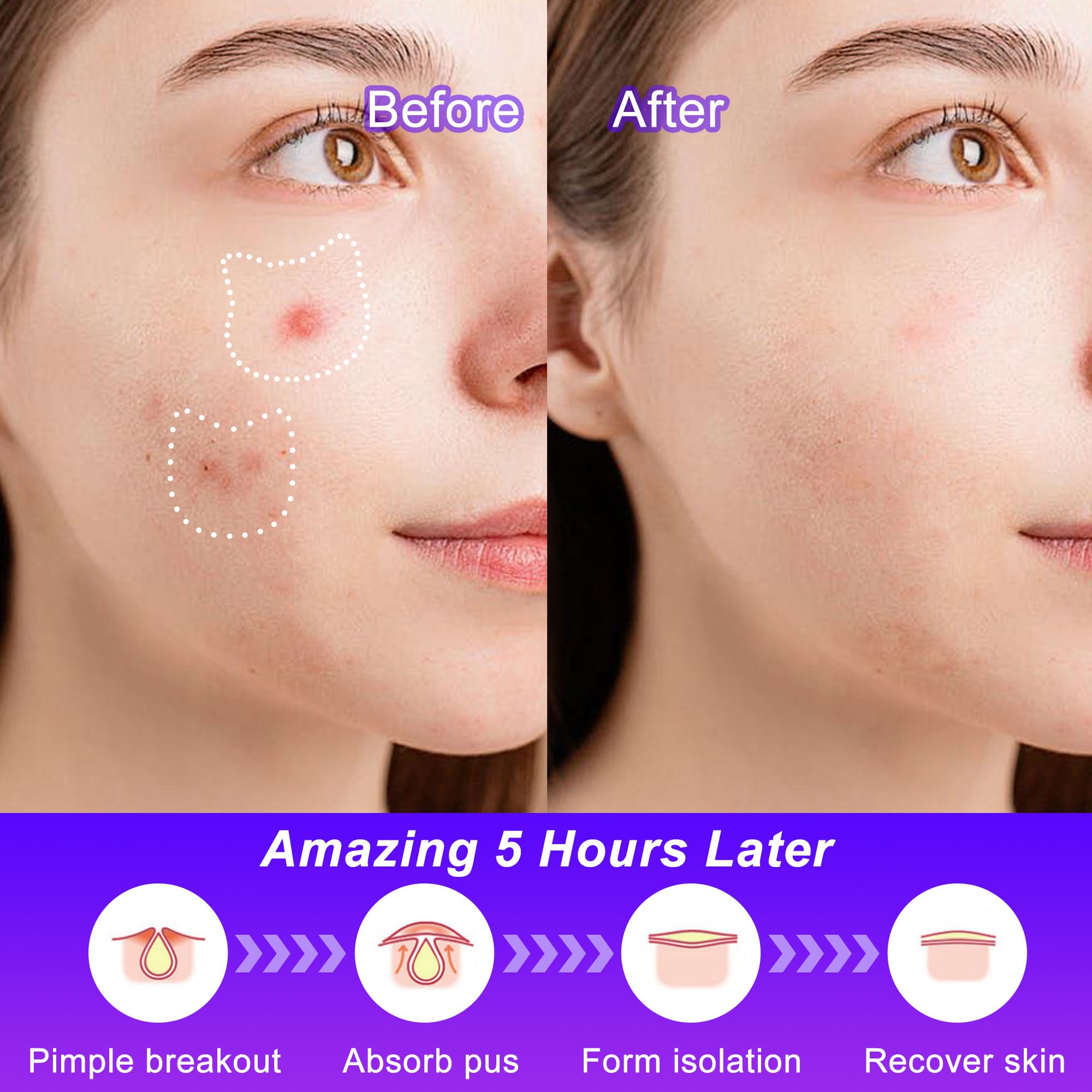 Application simple CELECARE: nettoyer puis appliquer