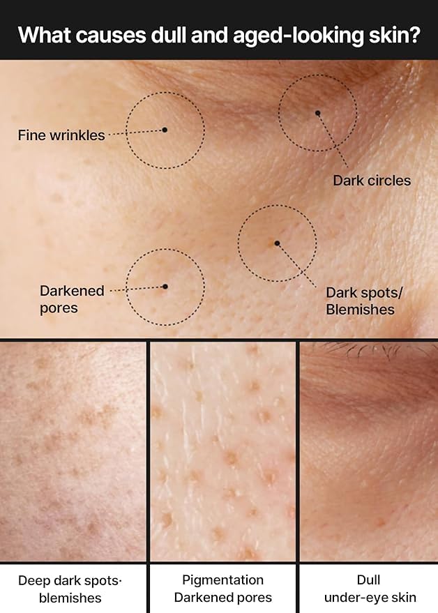 Hydratation profonde qui nourrit la peau du visage.
