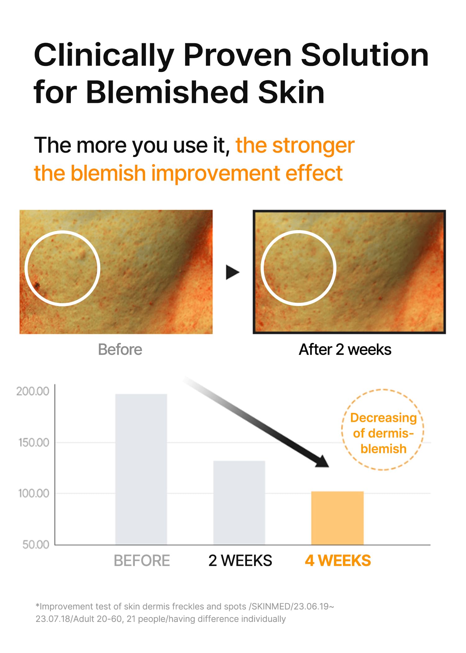 Celimax Pore+ peau sensible, formule douce et hypoallergénique.