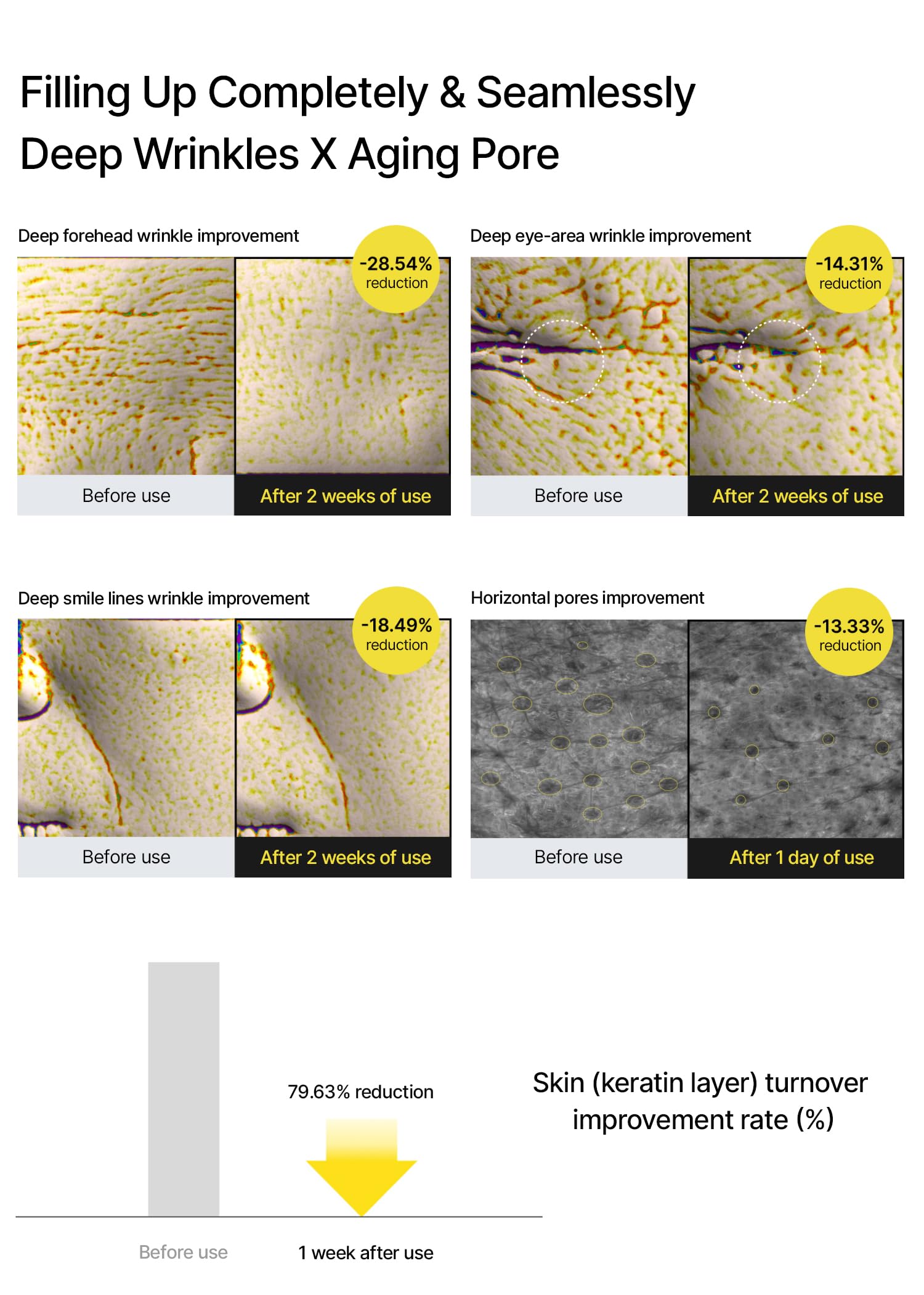 Formulation Liposomisée Matrixyl pour peau plus lisse.