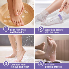 Bottillons jetables CÉLOR Foot Peel Mask prêt à l’emploi.