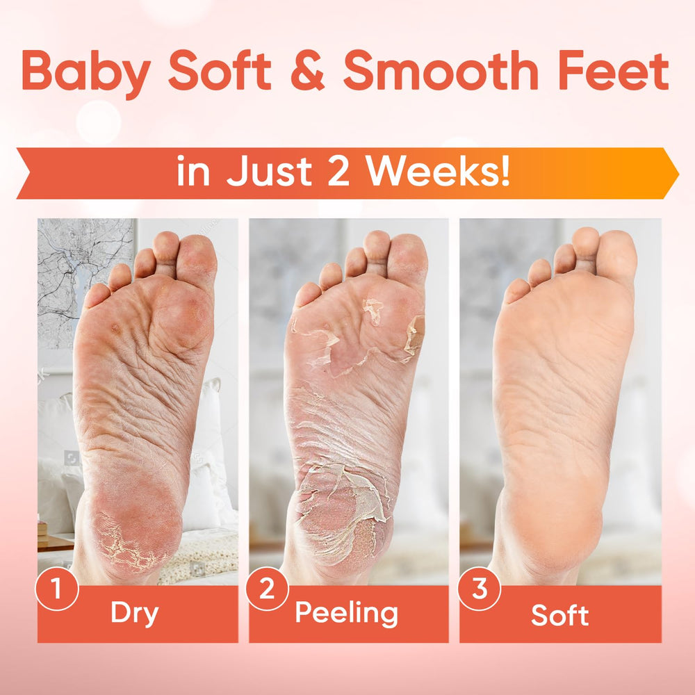Bottes jetables CÉLOR pour peeling des pieds à domicile, confort et simplicité.